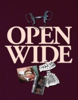 Open Wide